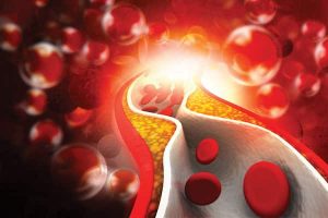 méz és érelmeszesedés